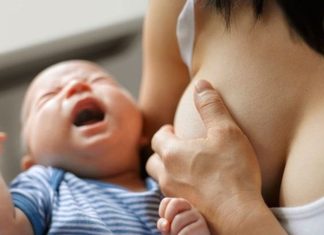 Quick and Safe Guidelines for Prevention and Treatment of Neck Cracks in Babies Due to Chicken Pox