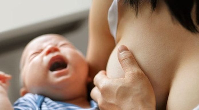 Quick and Safe Guidelines for Prevention and Treatment of Neck Cracks in Babies Due to Chicken Pox