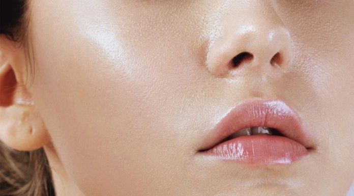 Effective Skincare Tips for Oily Acne-Prone Skin in Summer