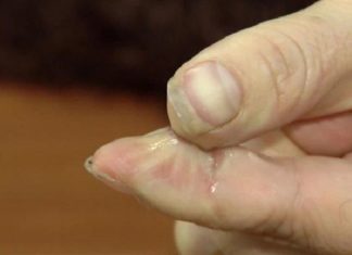 Quickly Remove 502 Glue from Skin – Here’s How