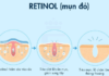 Retinol: A Fountain of Youth for Hair, Skin and Acne Prevention