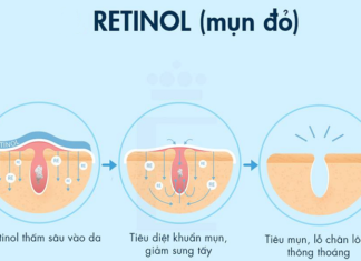 Retinol: A Fountain of Youth for Hair, Skin and Acne Prevention