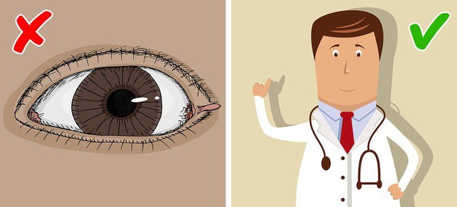 8 Easy and Effective Solutions for Skin Tag Removal in Women