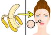 5 Astonishing Benefits of Banana Peels To Women: Scar Treatment, Anti-Aging, And More!