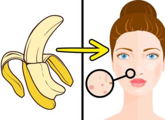 5 Astonishing Benefits of Banana Peels To Women: Scar Treatment, Anti-Aging, And More!