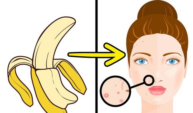 5 Astonishing Benefits of Banana Peels To Women: Scar Treatment, Anti-Aging, And More!