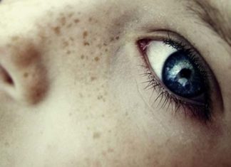 New Natural Treatment for Dark Spots on Skin