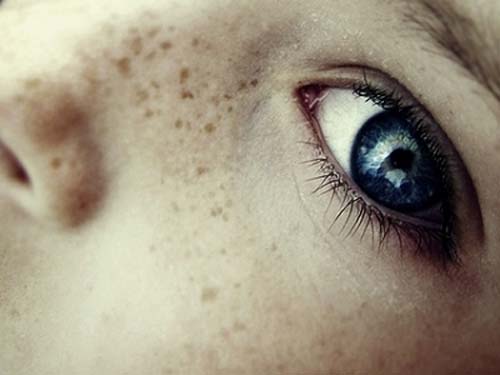 New Natural Treatment for Dark Spots on Skin