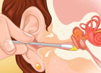 The Dangers of Cleaning Your Ears with Cotton Swabs