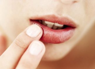 Treating Cracked and Chapped Lips in the Changing Seasons: How to Give Emergency Care