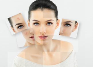 Showcasing Beauty with a Natural Look