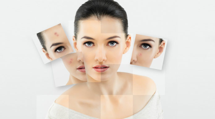 Showcasing Beauty with a Natural Look