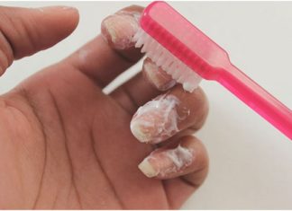 Discover the “Magical Remedy” for White and Pink Nails at Home!