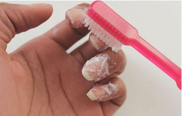 Discover the “Magical Remedy” for White and Pink Nails at Home!