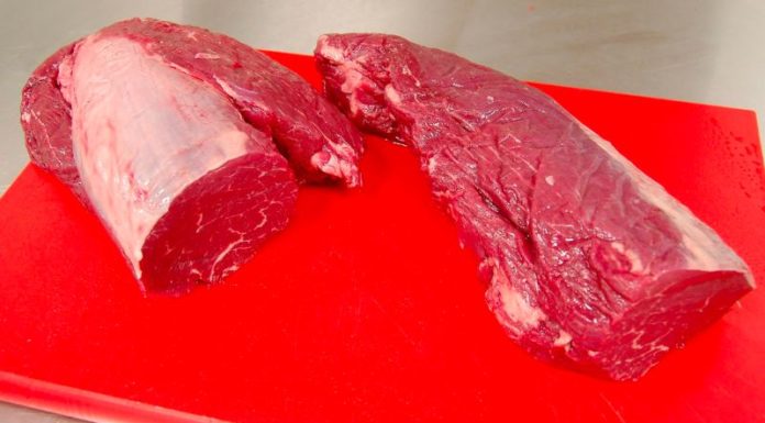 Understanding Different Types of Tendons: A Simple Guide