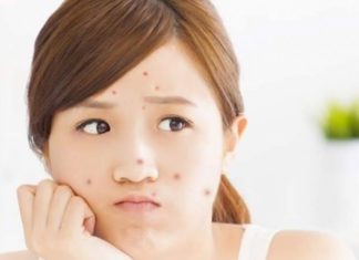 Should Dark Spot Pills be Used and What Are They?