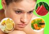 16 Affordable Ingredients with Magical Effects to Remove Dark Spots and Hyperpigmentation on Face