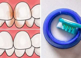Simple Ways to Achieve High Teeth at Home