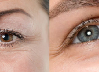 6 Simple Ways to Erase Eye Wrinkles and Preserve Youthful Look