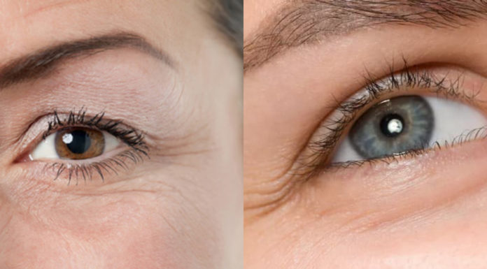 6 Simple Ways to Erase Eye Wrinkles and Preserve Youthful Look