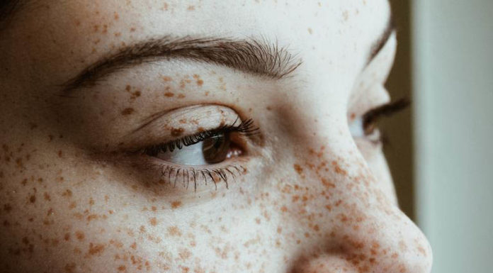 5 Simple Ingredients to Banish Stubborn Acne and Achieve Smooth, Glowing Skin