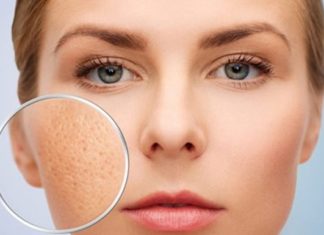 7 Reasons for Clogged Pores and Increasing Acne