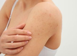 Unveiling some ways to exfoliate dead skin and reduce thickened horny follicles every time winter comes