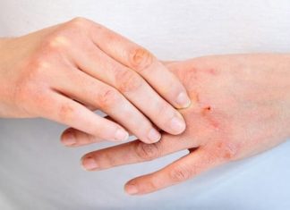 Pocket the basic skincare tips when dealing with sensitive skin