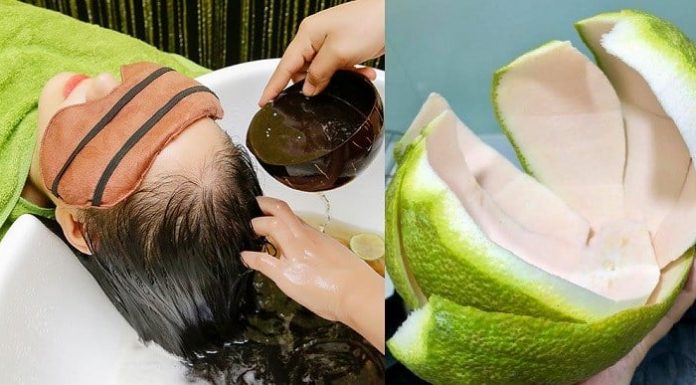 Reducing Hair Fall with These 3 Uses of Watermelon Rind