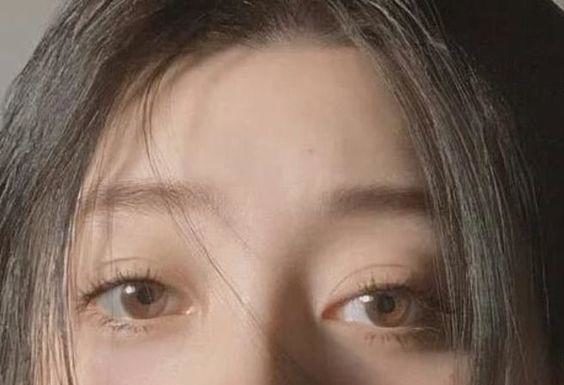 8 Nutrients to Reduce Dark Circles and Restore Freshness to the Skin