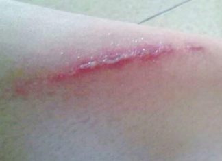 Effective Ways to Get Rid of Ants