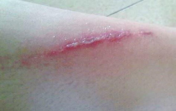 Effective Ways to Get Rid of Ants