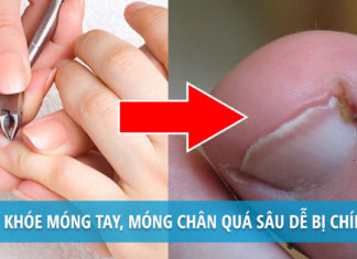 How to Treat Athlete’s Foot?