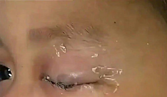3-year-old boy accidentally pours super glue into his eyes, dad adds one thing, doctor praises: “You saved your child’s life.”