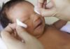 Should I put breast milk in my baby’s eye to treat redness?
