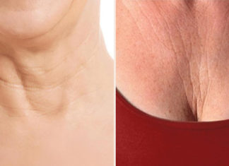 Unwrinkle your décolletage and defy aging signs, how to prevent?