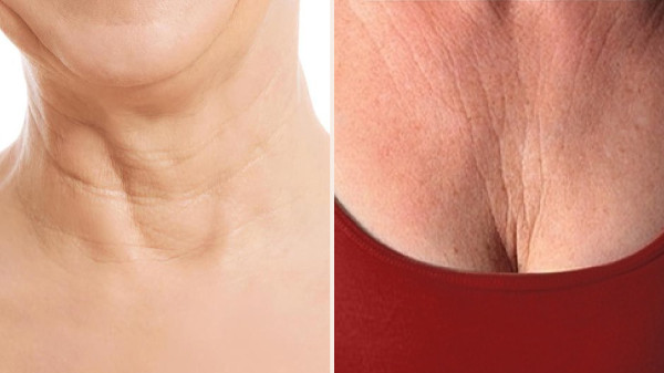 Unwrinkle your décolletage and defy aging signs, how to prevent?