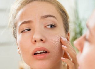 Winter Skin Cracked and Dry: Try This for Radiant, Hydrated Skin, with No Cost