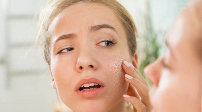 Winter Skin Cracked and Dry: Try This for Radiant, Hydrated Skin, with No Cost