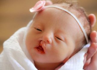 4 Common Congenital Defects in Newborns Every Parent Should Know