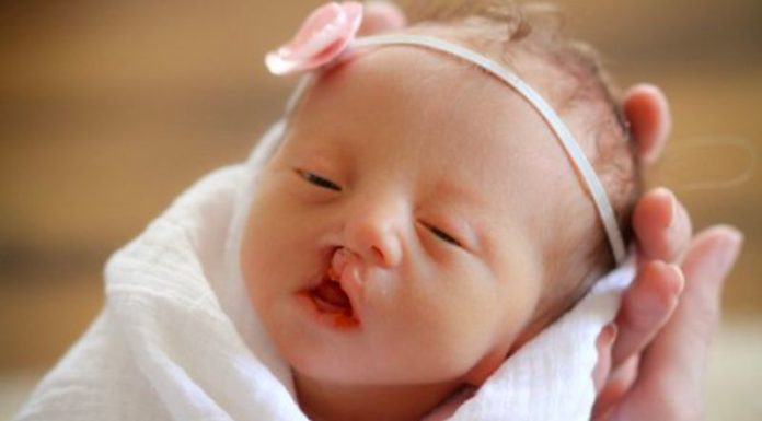 4 Common Congenital Defects in Newborns Every Parent Should Know