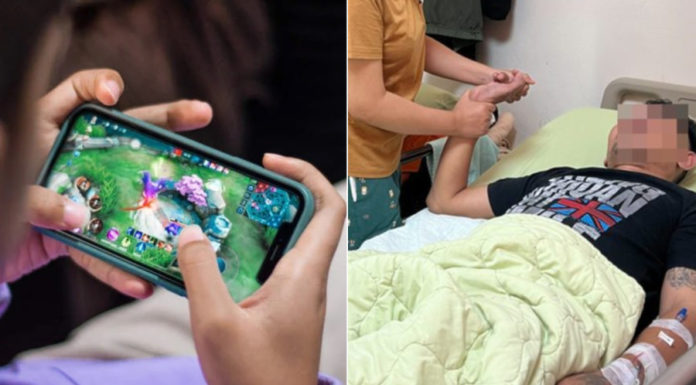 Reduced life expectancy in young adults due to stroke caused by cerebral hemorrhage, says doctor