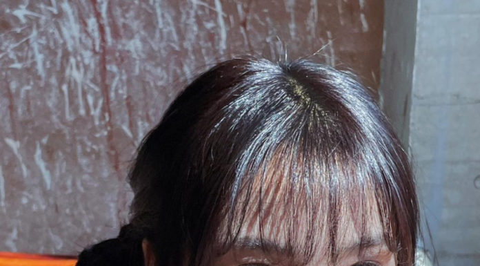 6 Eye Massage Exercises for Reducing Eye Bags and Tightening the Skin to Fight Aging