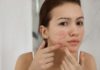 Tips to get rid of acne at home, prevent acne recurrence