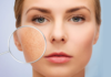Don’t let large pores bother you anymore, apply these 5 tips right away to help tighten your pores quickly in just a few minutes.