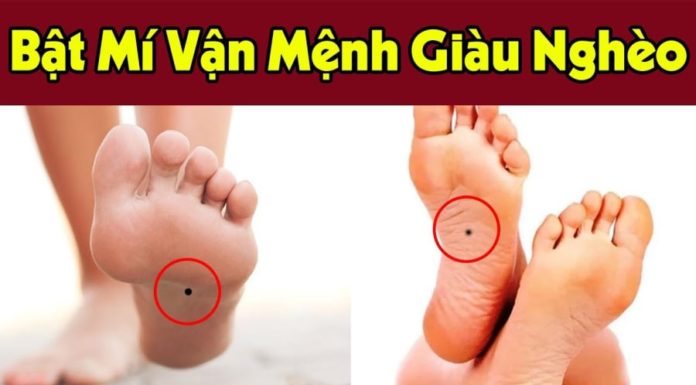 3 Moles on a Child’s Body: The Key to Future Success