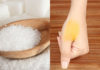 10 Ways to Quickly Clean Turmeric-Stained Hands