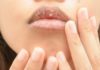 Tips for dealing with dry and cracked lips in the winter, alleviating discomfort for women