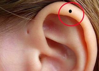 The Secret to Financial Freedom: Unveiling the Lucky Mole Placement for Both Men and Women