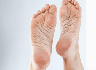 Get Smooth and Soft Heels with this Natural and Affordable DIY Solution
